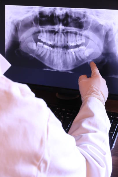 Best Urgent Care for Lost Fillings or Crowns in Canton, MO