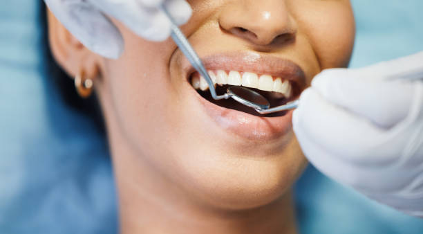 Best Emergency Tooth Extraction in Canton, MO